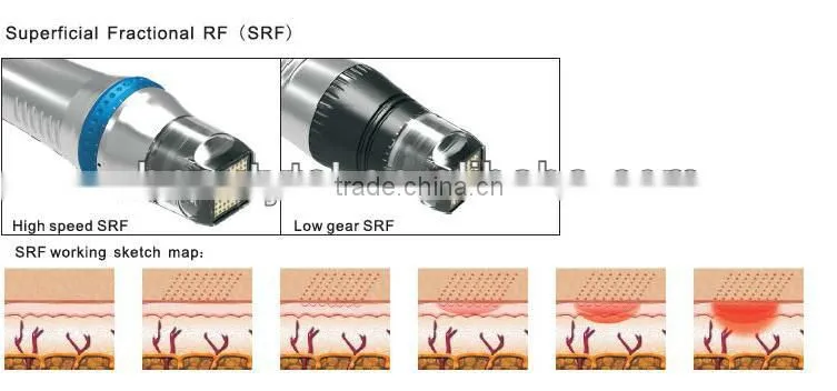 SFR MFR fractional rf SRF RF fractional equipment 25/49/81 pins