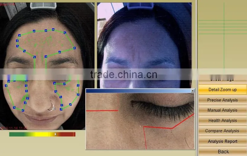 3d Facial skin analyzer machine with CE certification