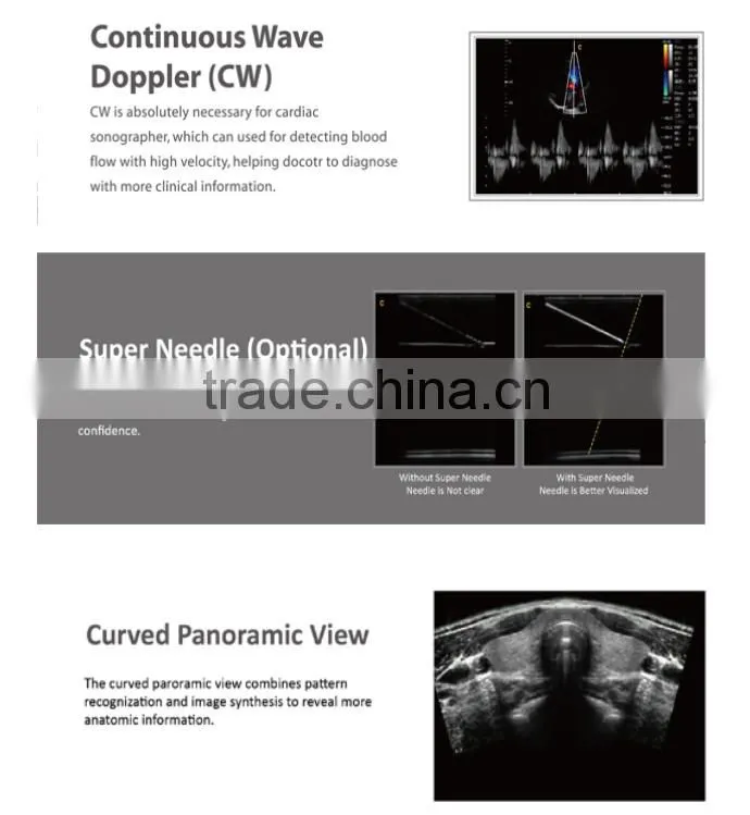 2016 new Portable Color Doppler(Optional 4D) for cardiac use