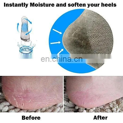 Spa Dry Hard Heel Moisturizing Gel Socks