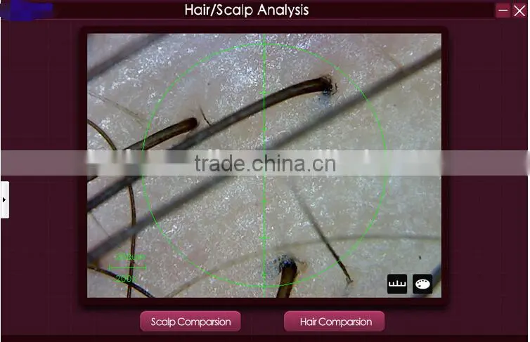 200X digital microscope scalp detector