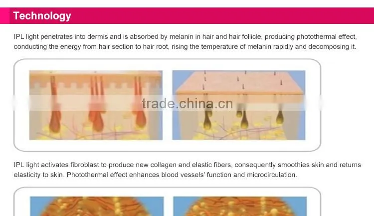 DEESS IPL laser permanent hair removal at home with replaceable lamp