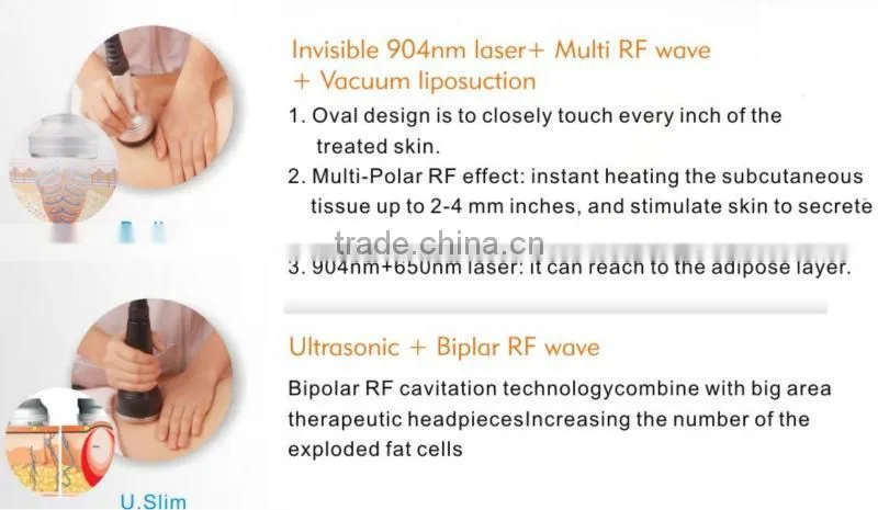 Hot Sale Cavitation and Vacuum RF Slimming Machine for Weight Loss