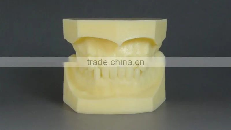 Malocclusion Classification Demonstration Model 2