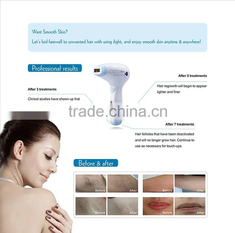IPL Hair Removal Device(iLight) at home use 150,000 shots