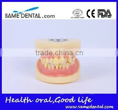 Dental Extraction Model School Teaching Model Teeth Model