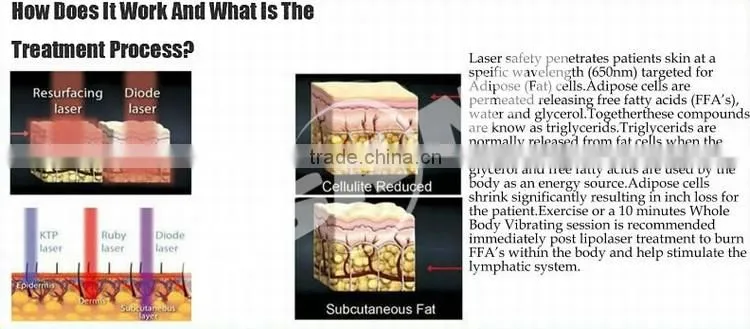 Low Level Laser Therapy Slimming Equipment
