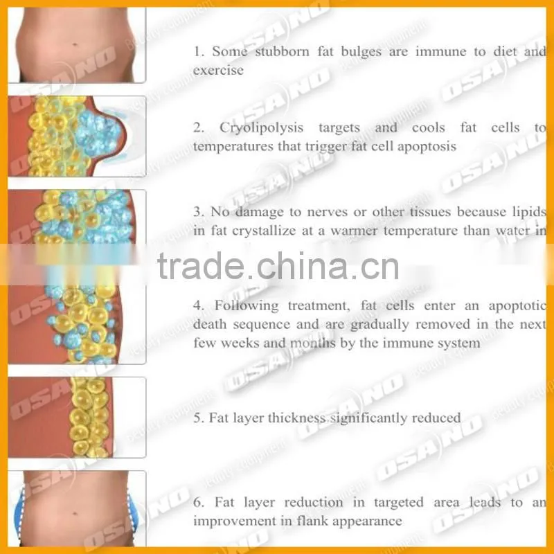 Distributors Opportunity / Frozen Lipo Cooling Fat / Remove Abdomen Slim Cryotherapy-Machine