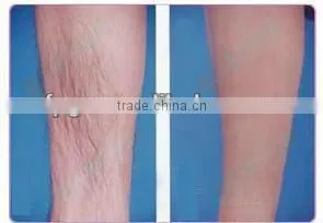 Professional Latest Portable IPL Beauty Machine FP-Laser