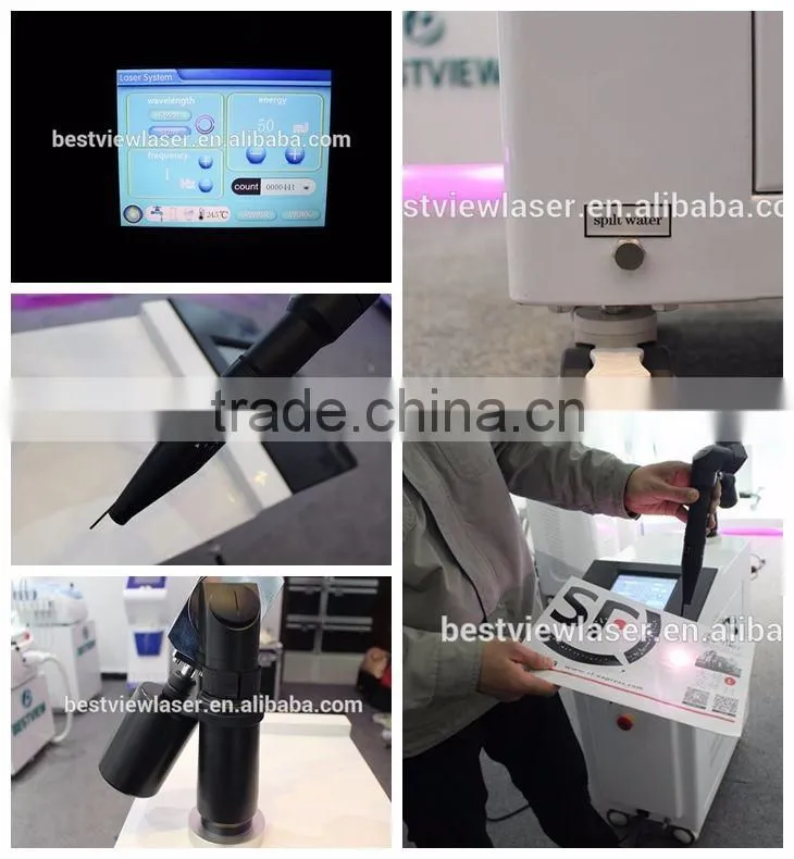 Fashionable updated beauty nd yag machine for tattoo laser /scar removal
