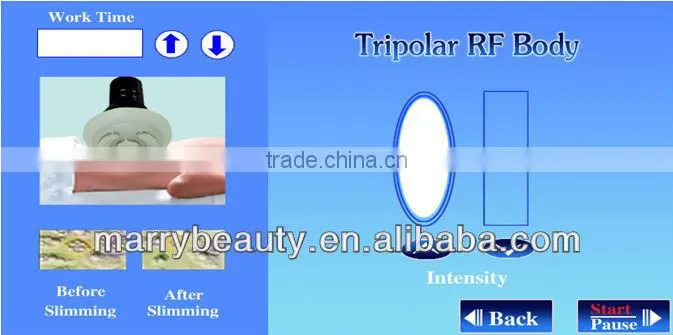 New Product Tripolar RF 40K Cavitation Machine