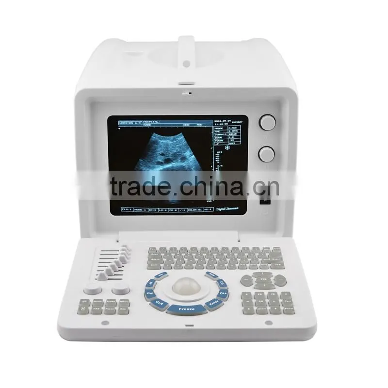 JOYMED Ultrasound for Human