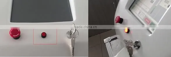 10 hz nd yag laser for tattoo removal 1320nm diy yag laser beauty machine