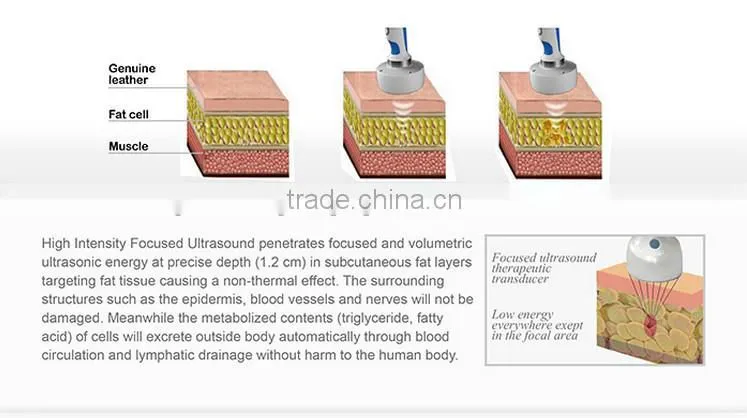 hifu slimming machine price, hifu 13mm fat removal, home hifu machine