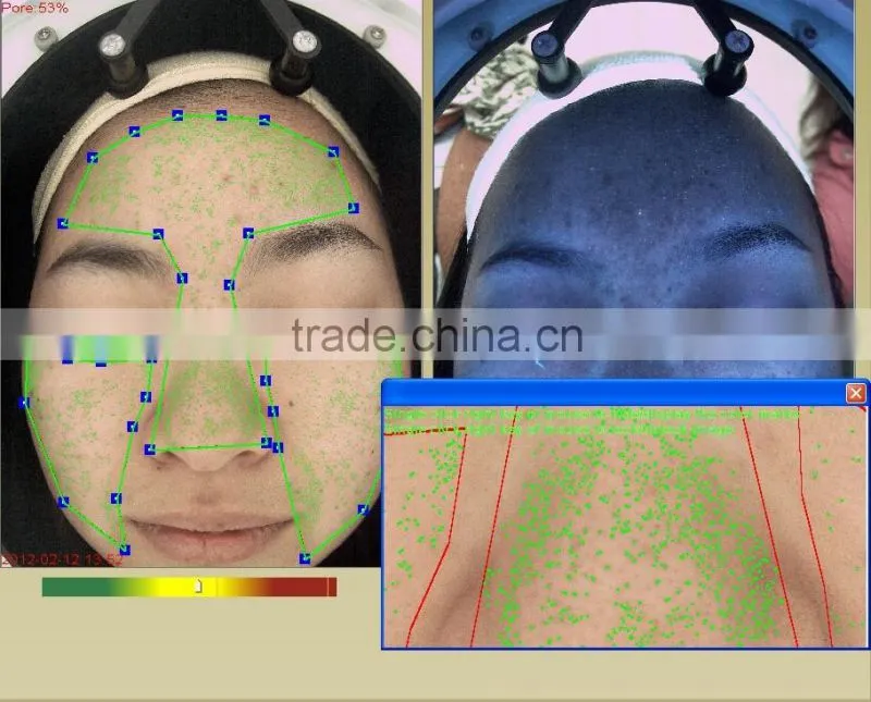skin analyzer magnifier machine skin analysis system