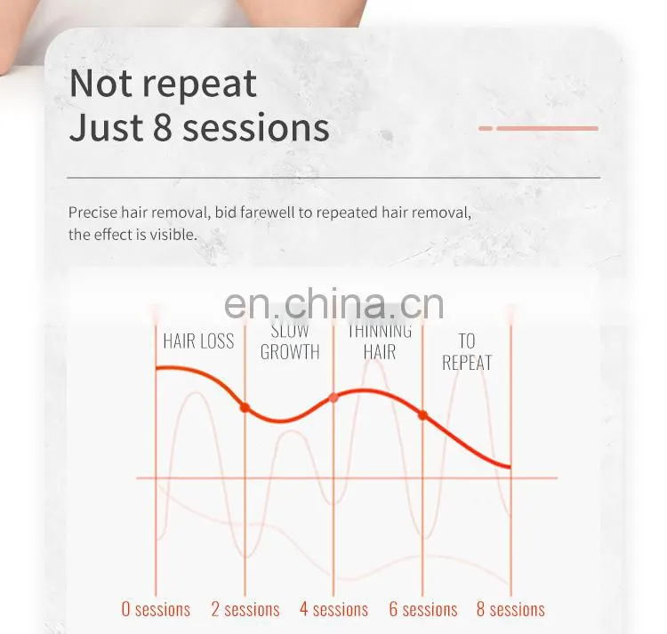 Permanent Hair Remover Alexandrite Laser 3 Wavelengths 808 755 1064 Diode Laser Hair Removal