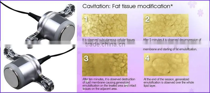 Slimming Treatment Session Ultrasonic Liposuction Cavitation RF Vacuum Massage The Skin Wellness Machine