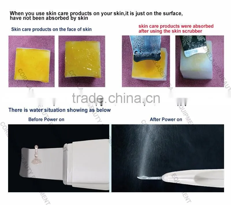 Portable New arrival ultrasonic cleaners ultrasonic skin scrubber with CE approved