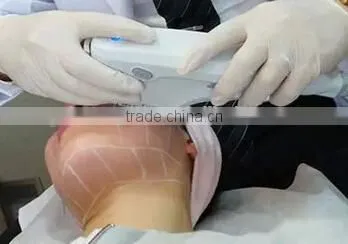 Ultrasound transducer type high intensity ultrasound