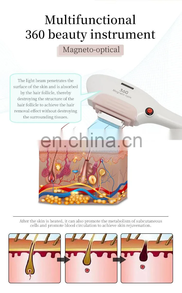 360 magneto-optical OPT SHR fast hair removal device picosecond laser eyebrow washing IPL rejuvenation beauty Instrument