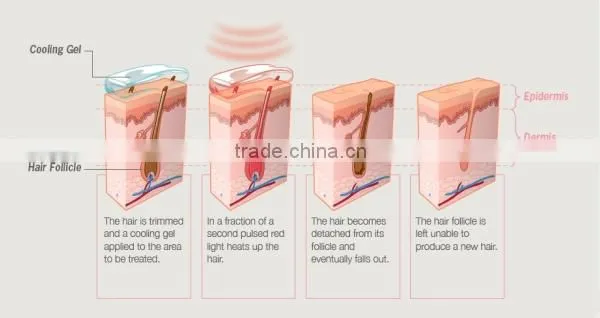 N2 Portable Mini IPL Hair Removal Machine/ Home Use Laser Hair removal