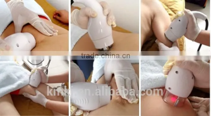2016 Hot sale ultrasonic liposuction cavitation machine for slimming