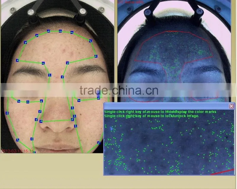 skin analyzer magnifier machine skin analysis system