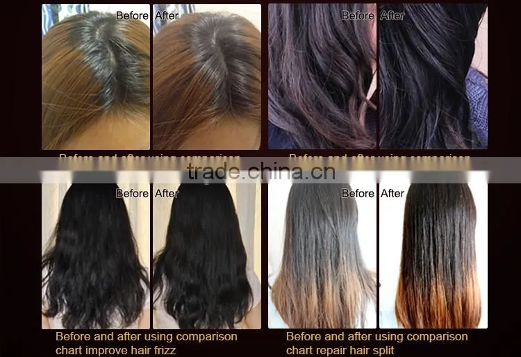 Hair laser comb to massage scalp laser hair loss treatment