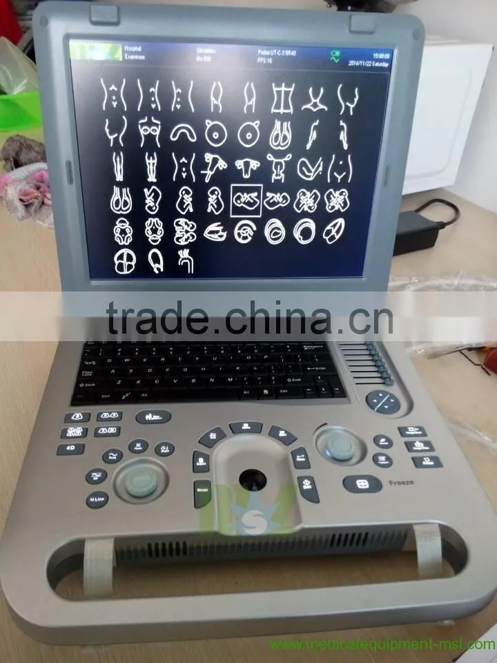 ultrasound machine ,ultrasound machine price,ultrasound scanner