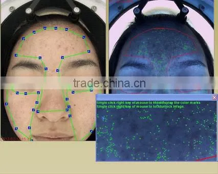 2016 popular portable magic mirror skin analyzer skin analysis machine