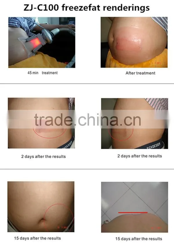 CE approval 4 handles cryolipolysis fat freezing machine / cryolipolysis beauty machine