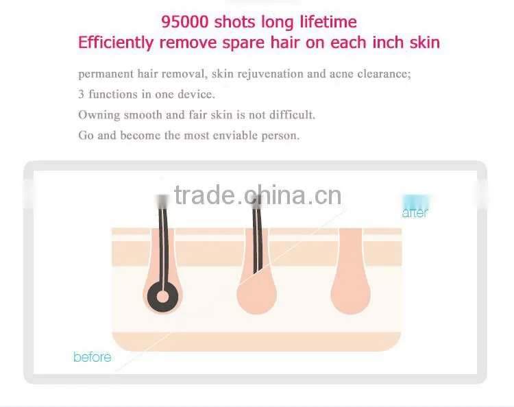 DEESS electronic equipment portable radio frequency face lift device beauty products for skin care