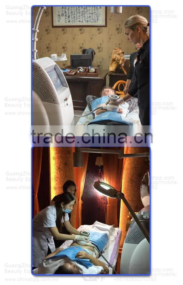 HIFU ultrashape best new slimming technology machine