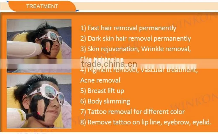 Most effective professional ipl xenon flash lamp 4 in 1 multifunction laser device