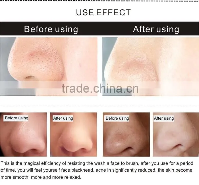 Free samples facial cleansing brush factory directly sale