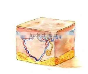 Patent contact cooling tips ICE SHR technology hair removal aesthetic equipment ICE 1