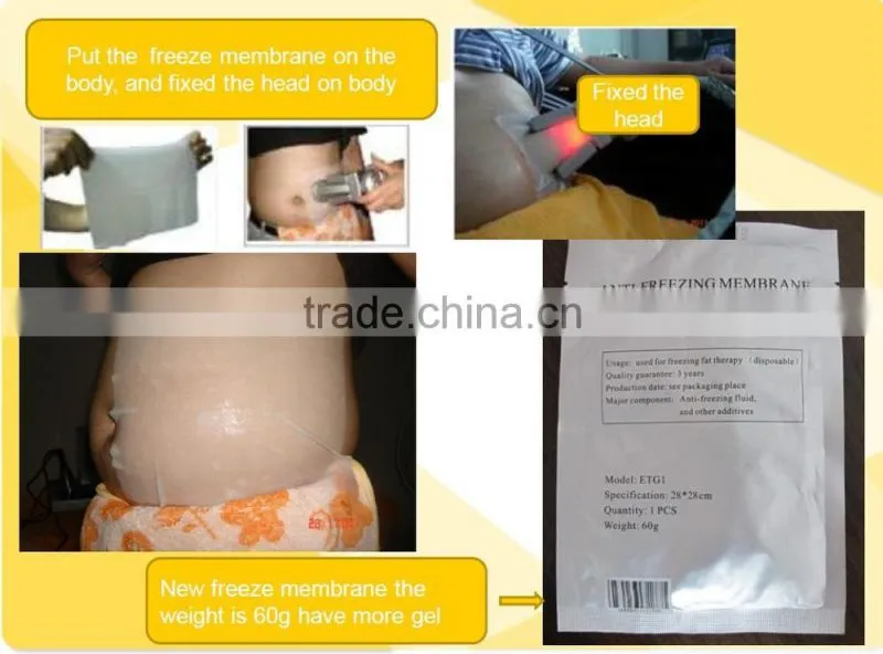 cryolipolysis antifreeze membrane//antifreeze membrane for freeze fat machine