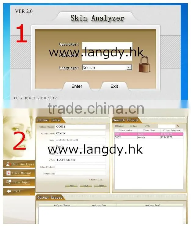 Auto facial skin portable analyzer with customer datebase and 10 mega pixels camera