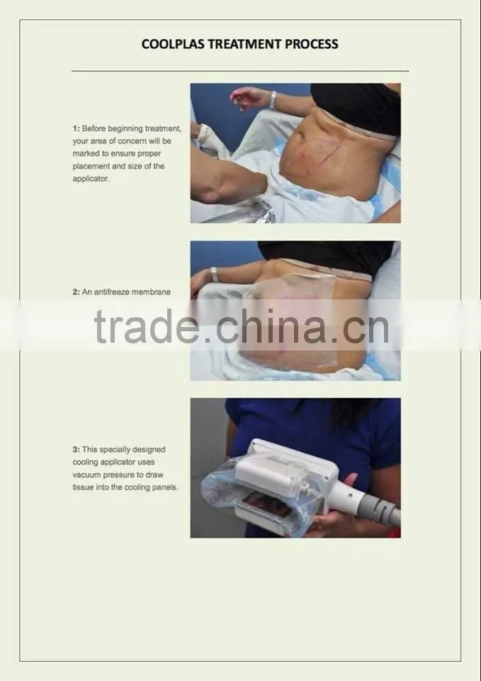 Sincoheren Coolplas fat freezing machines for slimming