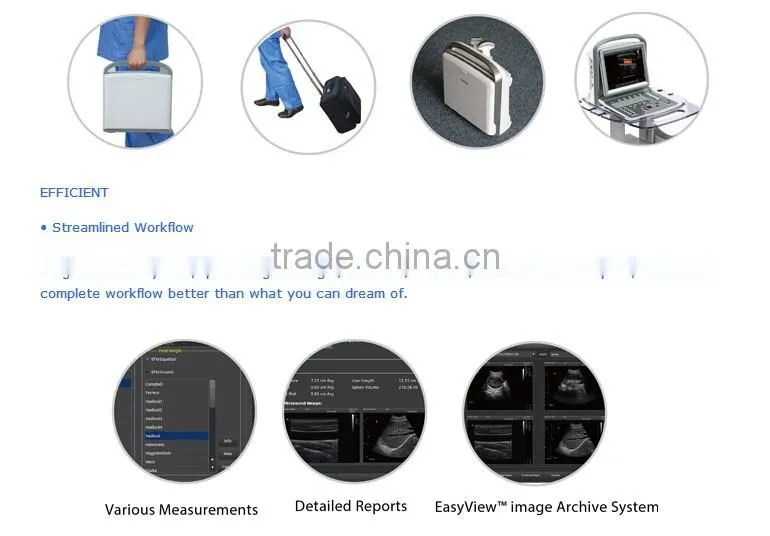 China cheap price USB portable laptop color doppler ultrasound scanner for pregnancy scanner ultrasound
