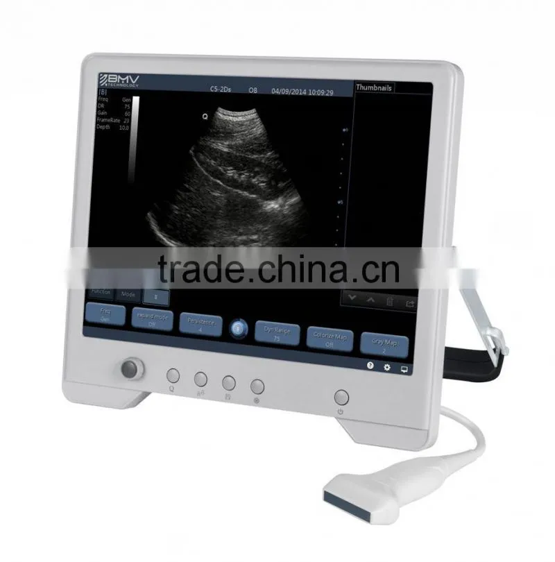 B&W touch screen ultrasound scanner/machine TS20