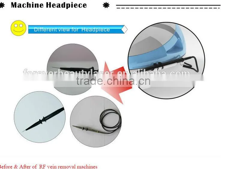 RBS vascular removal spider vein treatment spider vein removal beauty machine--RBS100 PROMOTION PRICE