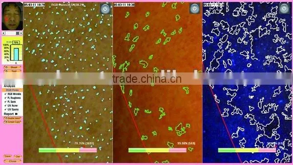 WT-03-S Super Trispectrum Magic mirror skin scanner analyzer