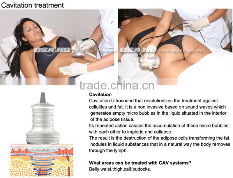 Cryolipolysis freeze fat cell slimming machine,fast fat cavitation slimming system