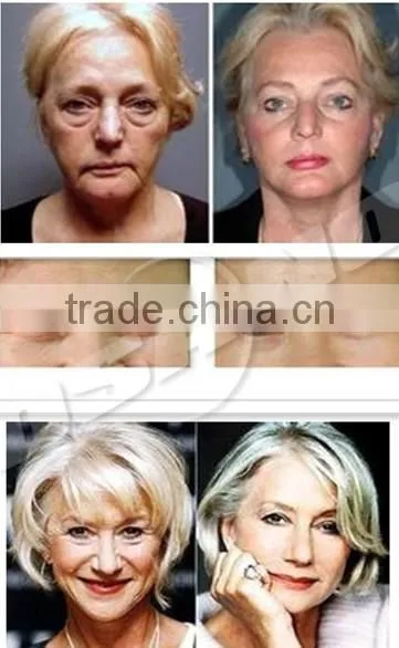 Salon beauty equipment face lifting home beauty equipment