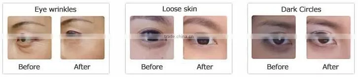 Eye fack mask, collagen eye patch