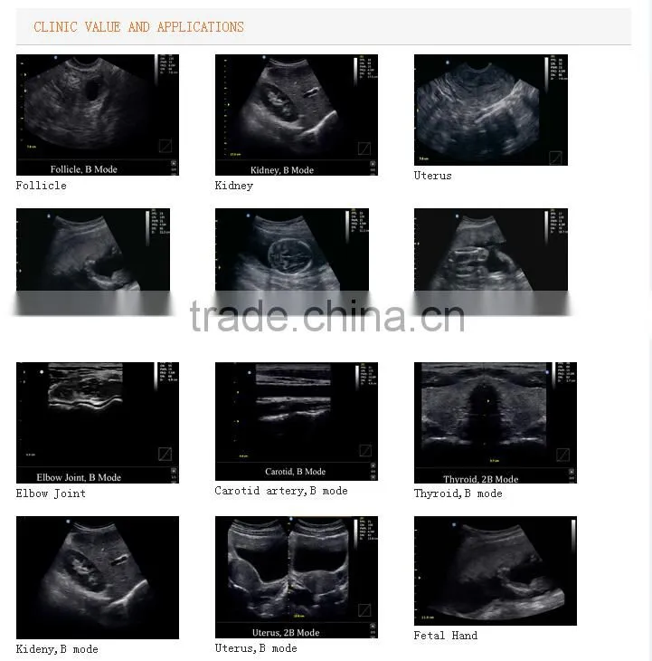 NEW Ultrasound Scanner ECO1 with 2.5-5.0MHz Convex probe for abdoment OB GYN Urology Vascular Small parts pediatrics cardiology