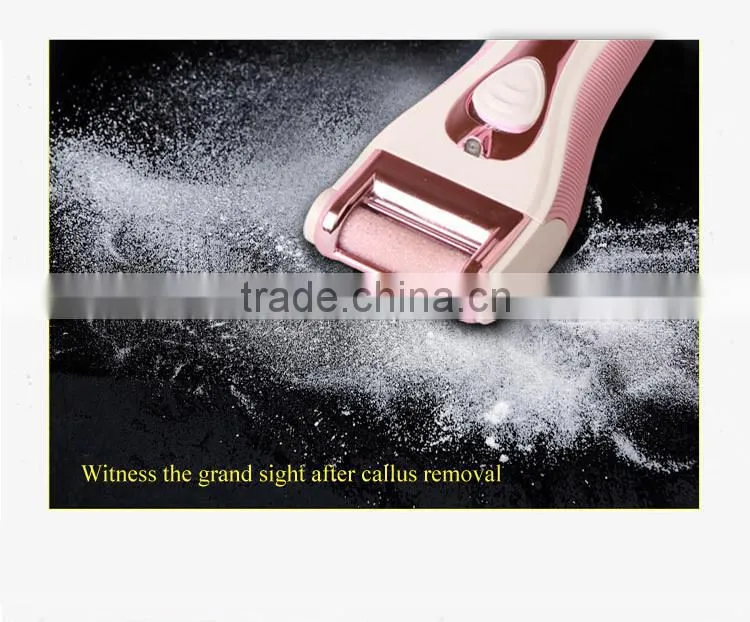 New Hot Callus Remover