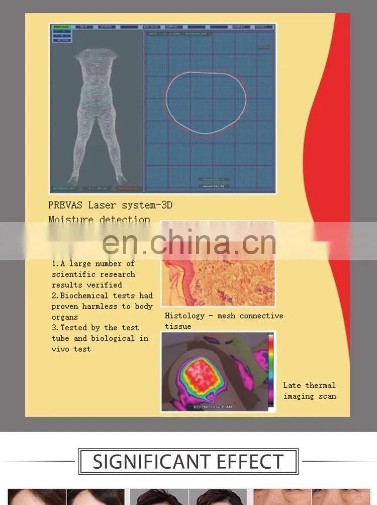 Skin Rejuvenation,Wrinkle Remover,Face Lift Feature and No IPL+ RF rf skin tightening machine