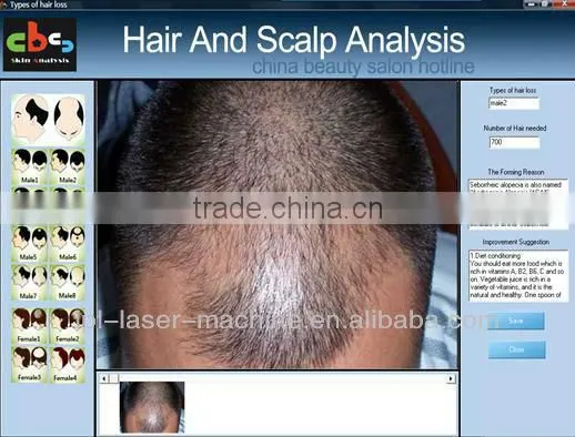 High definition hair analyzer mcahine